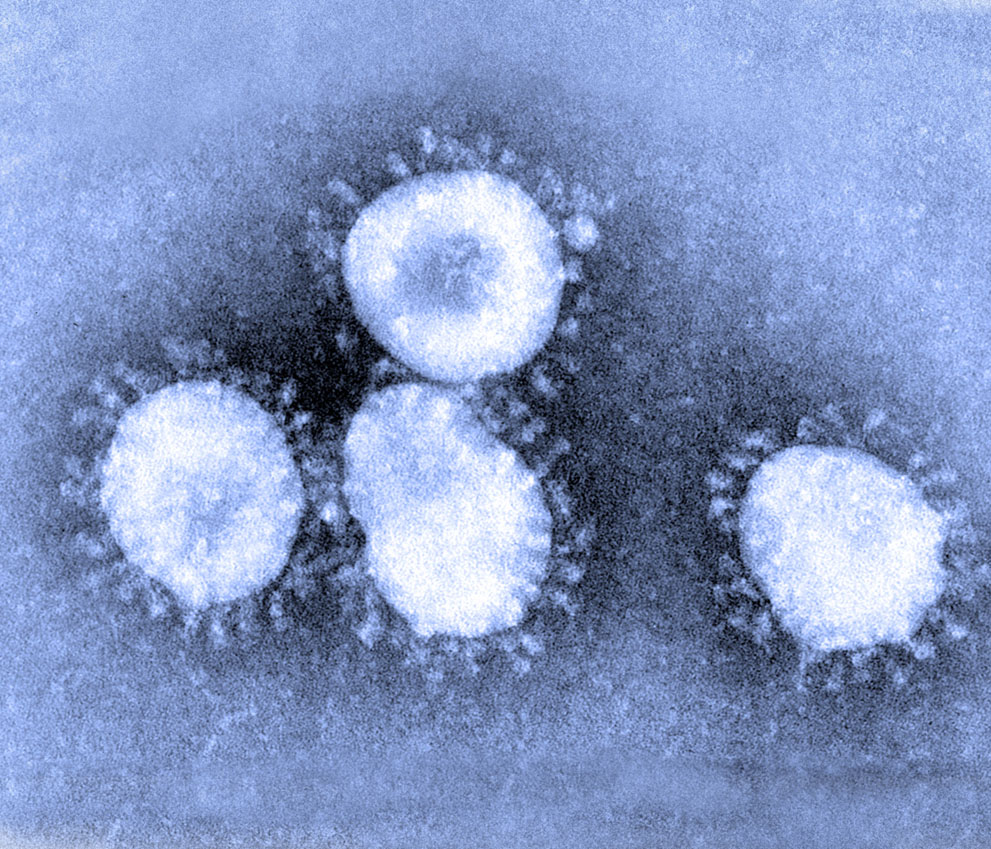 CORONAVIRUS