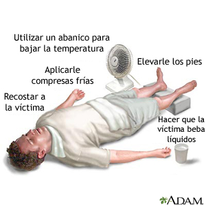 GOLPE DE CALOR